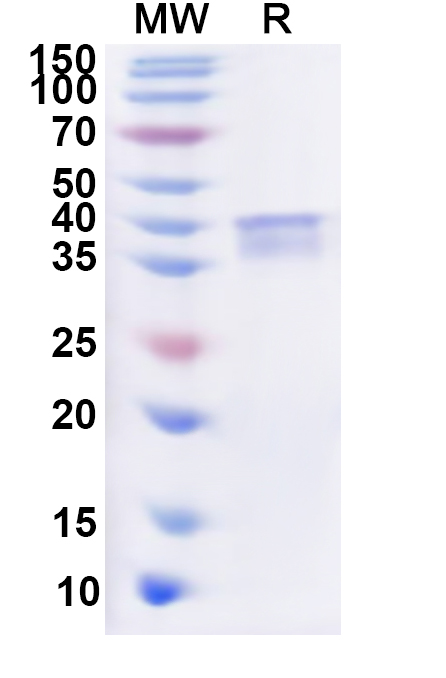 SDS-PAGE for Recombinant Human MAP3K8 Protein, N-His