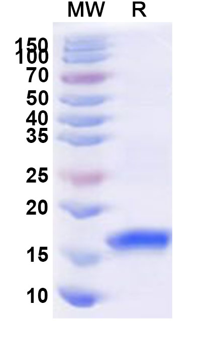 SDS-PAGE for Recombinant Human MAPRE2 Protein, N-His