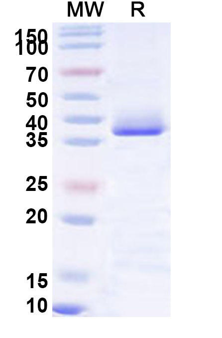 SDS-PAGE for Recombinant Human MARK1 Protein, N-His