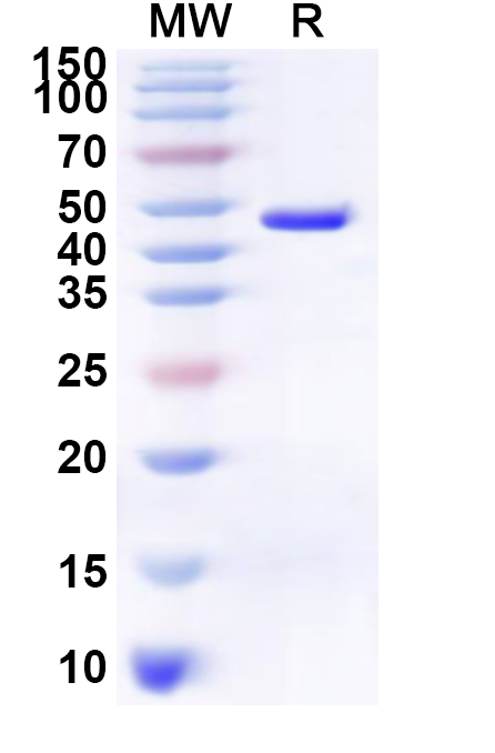 SDS-PAGE for Recombinant Human MAS1 Protein, N-GST & C-His