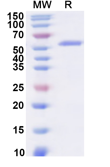 SDS-PAGE for Recombinant Human MATK Protein, N-His