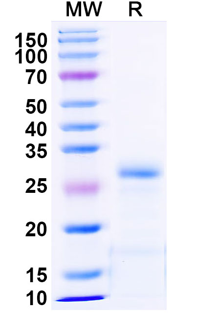 SDS-PAGE for Recombinant Human MBD1, N-His