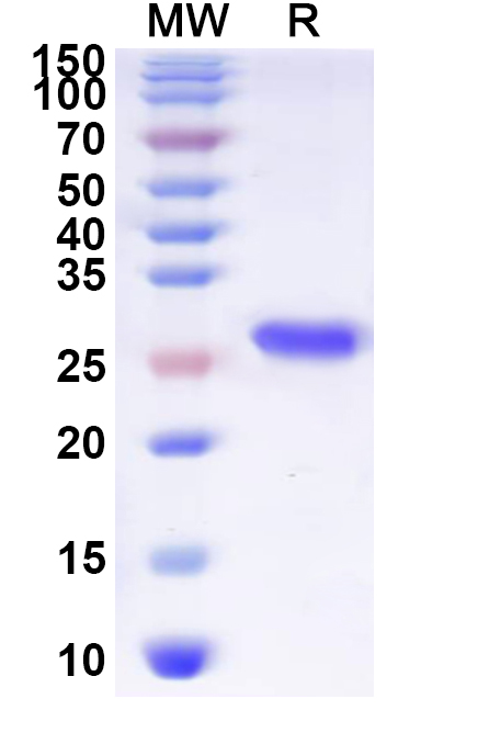 SDS-PAGE for Recombinant Human MC3R Protein, N-His-KSI