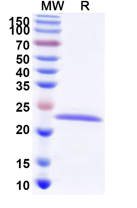 SDS-PAGE for Recombinant Human MCU, N-His