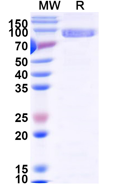 SDS-PAGE for Recombinant Human MDM2 Protein, N-His