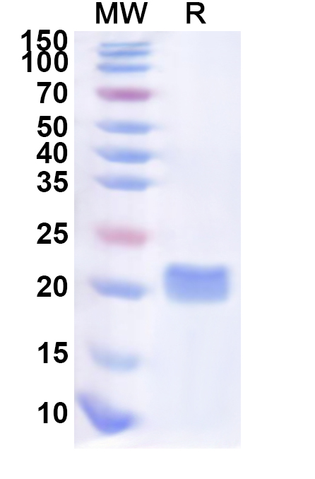 SDS-PAGE for Recombinant Human ME3 Protein, N-His