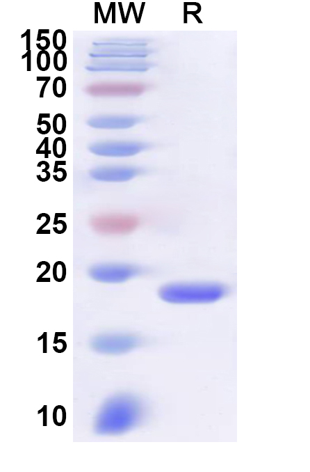 SDS-PAGE for Recombinant Human MED21 Protein, N-His
