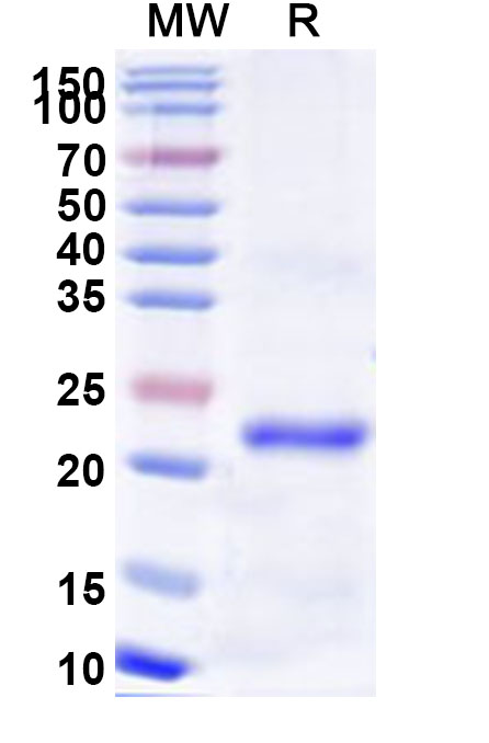 SDS-PAGE for Recombinant Human MEFV Protein, N-His