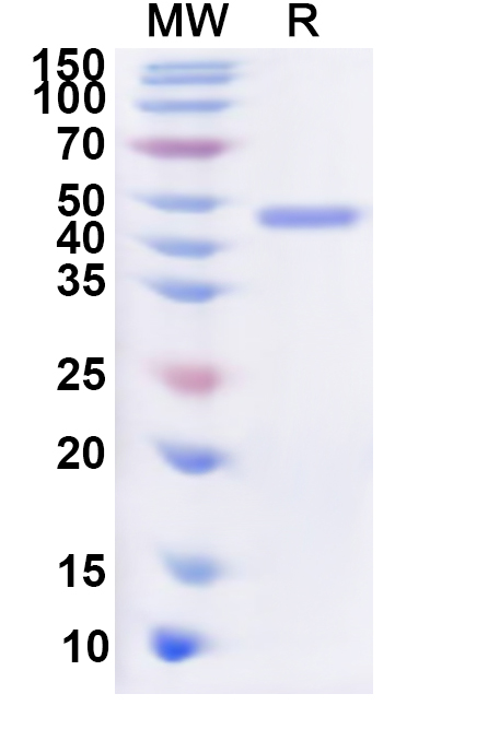 SDS-PAGE for Recombinant Human METAP2 Protein, N-His