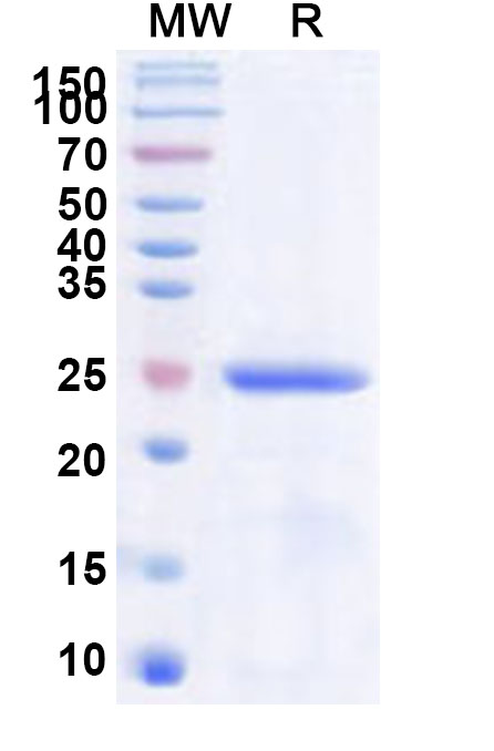SDS-PAGE for Recombinant Human METTL21C Protein, N-His