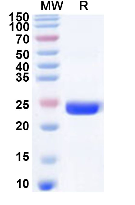 SDS-PAGE for Recombinant Human MEX3C Protein, N-His