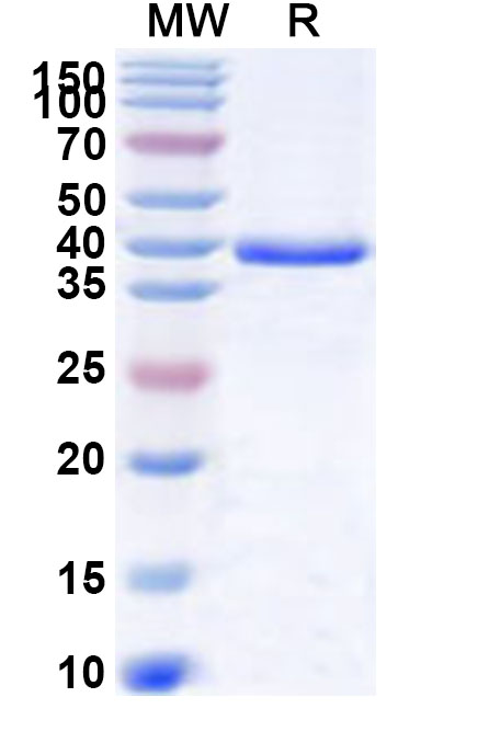 SDS-PAGE for Recombinant Human MGAT2 Protein, N-His