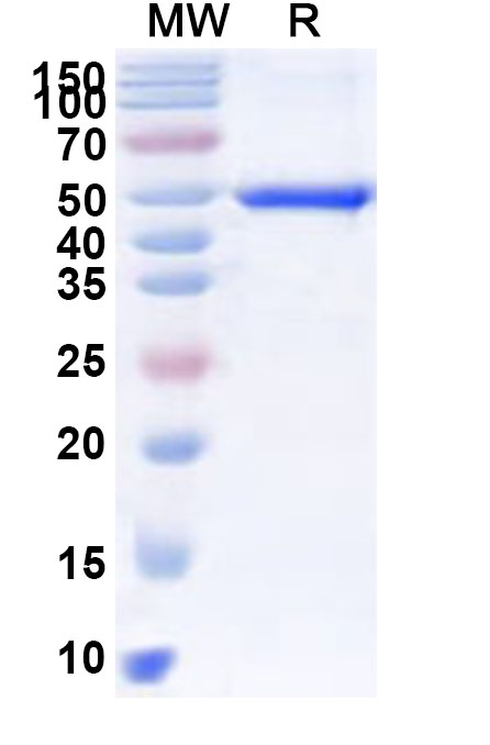 SDS-PAGE for Recombinant Human MGAT3 Protein, N-His