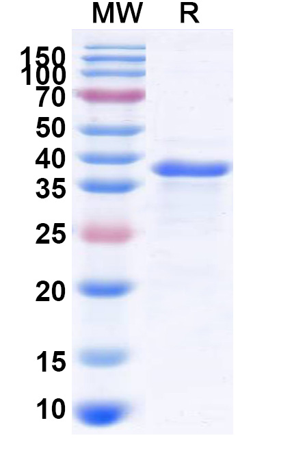 SDS-PAGE for Recombinant Human MIEF1 Protein, N-His