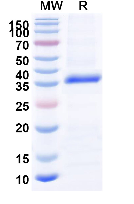 SDS-PAGE for Recombinant Human MIEF2 Protein, N-His
