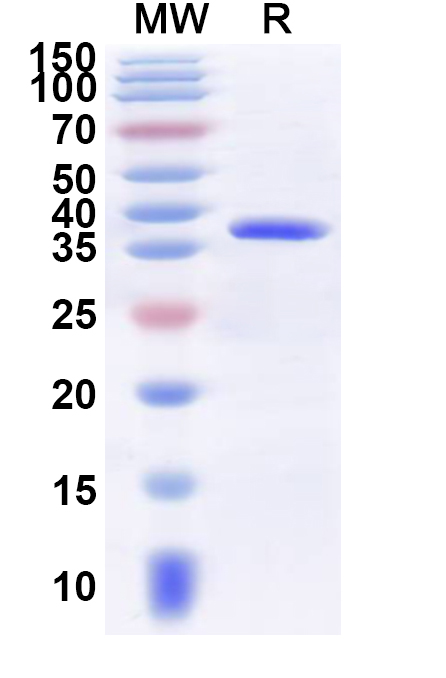 SDS-PAGE for Recombinant Human MLANA Protein, N-GST & C-His