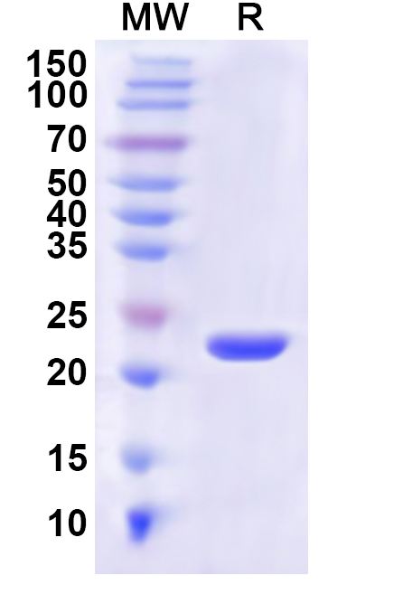 SDS-PAGE for Recombinant Human MLEC Protein, N-His