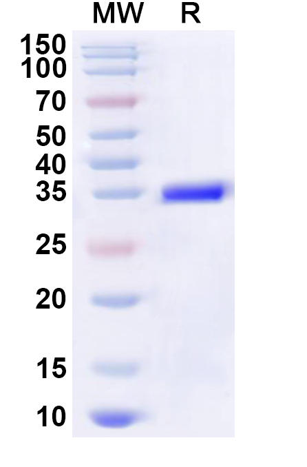 SDS-PAGE for Recombinant Human MOBP Protein, N-GST & C-His