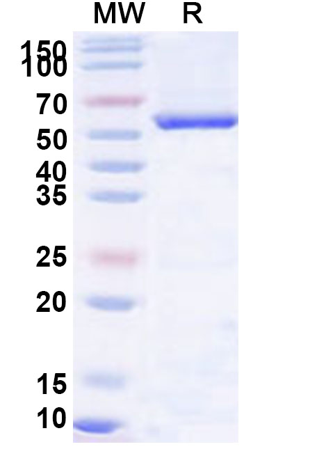 SDS-PAGE for Recombinant Human Monoamine Oxidase B/MAOB/AOFB protein,N-His