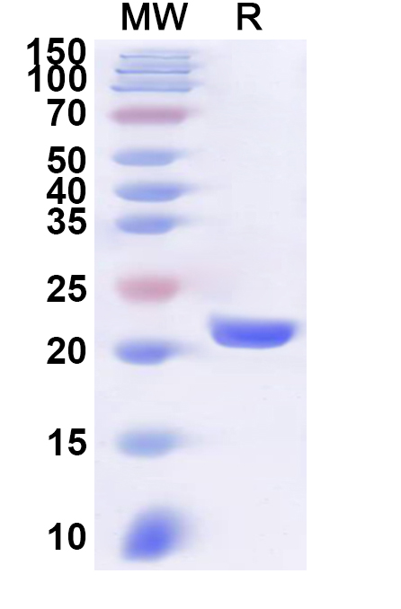 SDS-PAGE for Recombinant Human MORF4L2 Protein, N-His