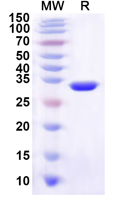 SDS-PAGE for Recombinant Human MORN3 Protein, N-His