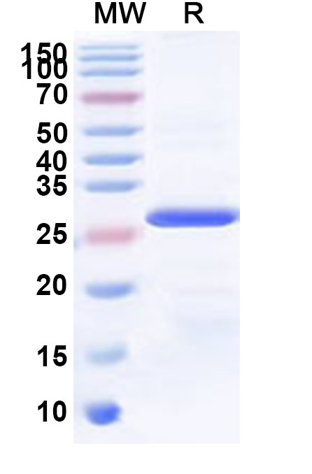 SDS-PAGE for Recombinant Human MPP7 Protein, N-His