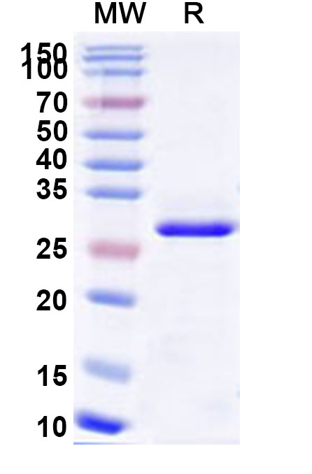 SDS-PAGE for Recombinant Human MRAS Protein, N-His