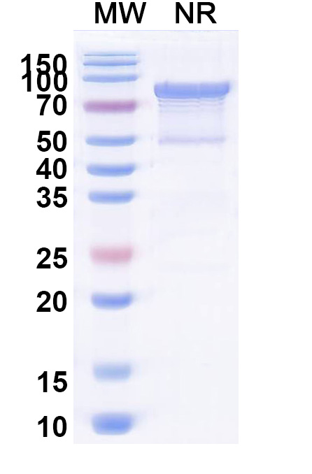 SDS-PAGE for Recombinant Human MRE11 Protein, C-His