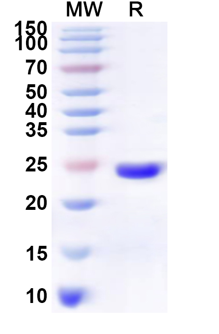 SDS-PAGE for Recombinant Human MS4A2 Protein, N-His-KSI