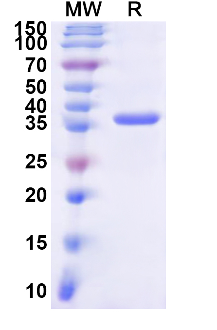 SDS-PAGE for Recombinant Human MSH3 Protein, N-His
