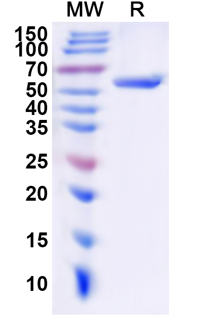SDS-PAGE for Recombinant Human MSX1 Protein, N-His-KSI
