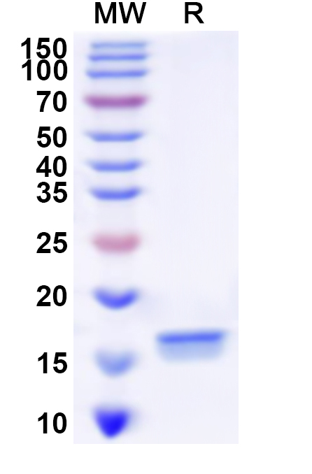SDS-PAGE for Recombinant Human MSX2 Protein, N-His