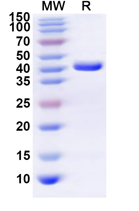 SDS-PAGE for Recombinant Human MTFP1 Protein, N-GST & C-His