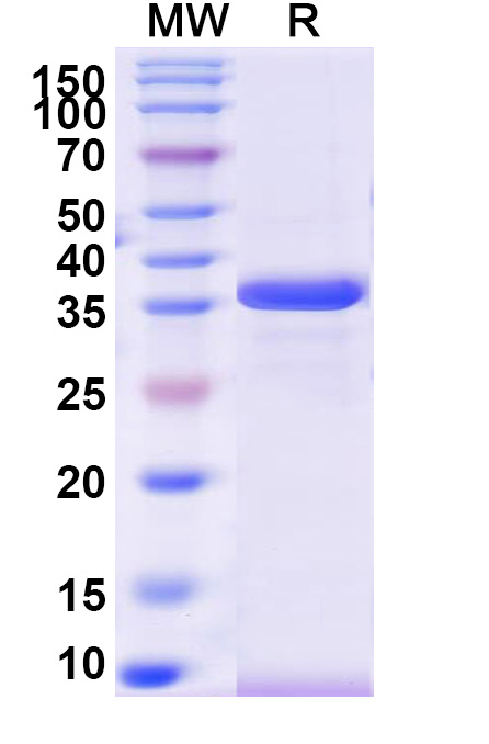 SDS-PAGE for Recombinant Human MTHFD1 Protein, N-His