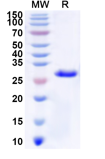 SDS-PAGE for Recombinant Human MTHFS Protein, N-His