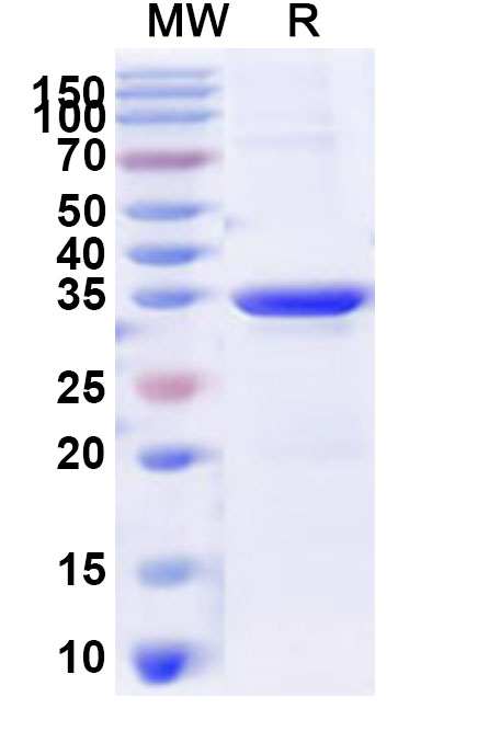 SDS-PAGE for Recombinant Human MTNR1B Protein, N-His-KSI