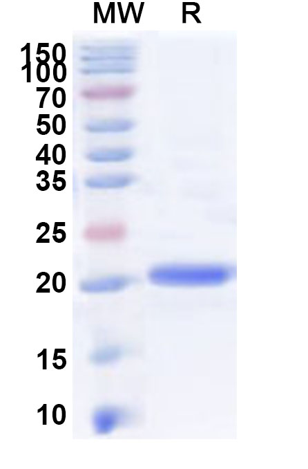 SDS-PAGE for Recombinant Human MTO1 Protein, N-His