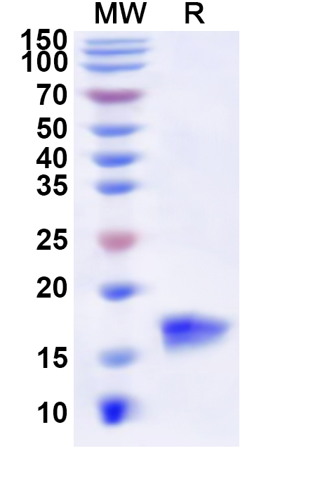 SDS-PAGE for Recombinant Human MTPN Protein, N-His
