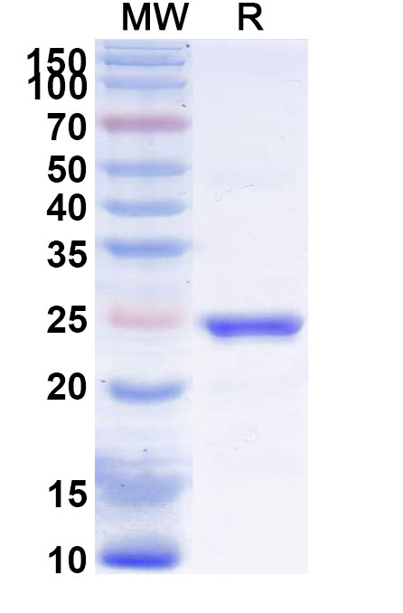 SDS-PAGE for Recombinant Human MUL1 Protein, N-His