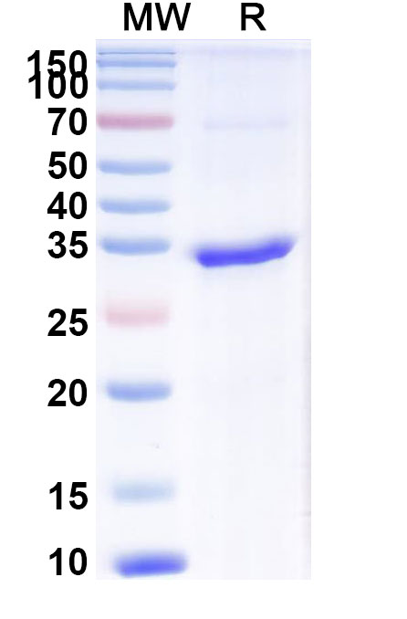 SDS-PAGE for Recombinant Human MXRA8 Protein, N-His