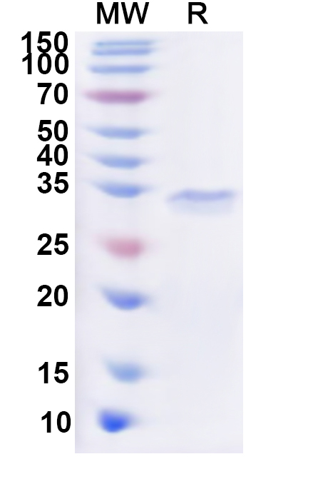 SDS-PAGE for Recombinant Human NAA10 Protein, N-His
