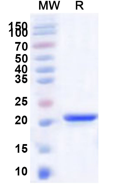SDS-PAGE for Recombinant Human NAA20 Protein, N-His