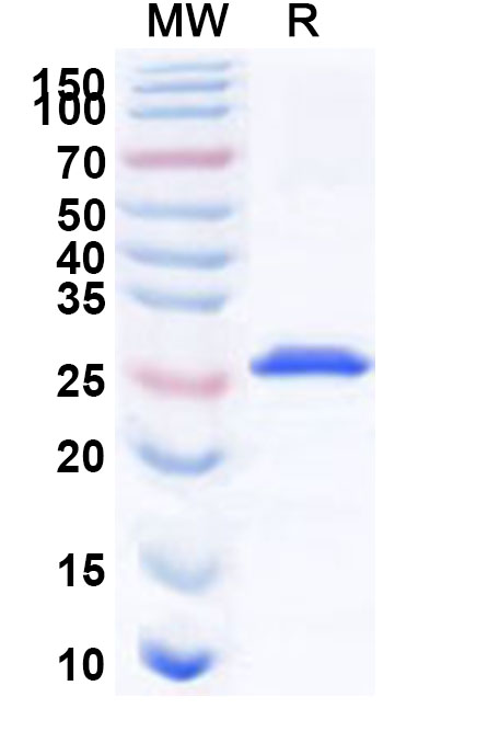 SDS-PAGE for Recombinant Human NAB1 Protein, N-His