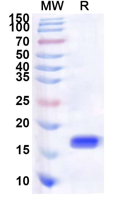 SDS-PAGE for Recombinant Human NAB2 Protein, N-His