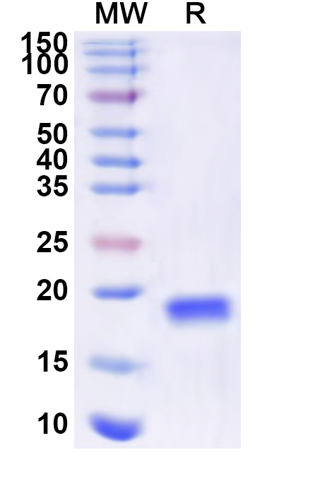 SDS-PAGE for Recombinant Human NANOS2 Protein, C-His