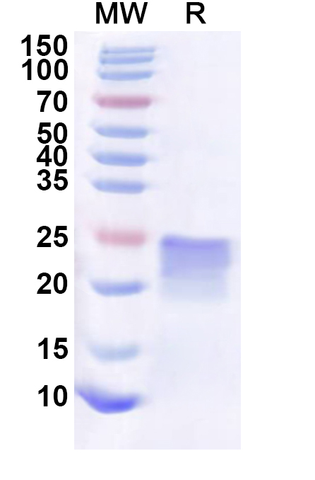 SDS-PAGE for Recombinant Human NBDY Protein, N-His-KSI