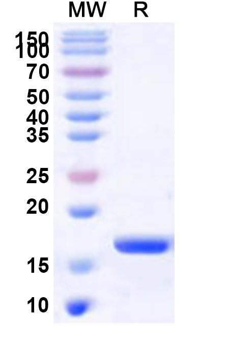 SDS-PAGE for Recombinant Human NCAPH2 Protein, N-His