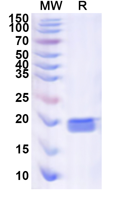 SDS-PAGE for Recombinant Human NCBP2 Protein, N-His