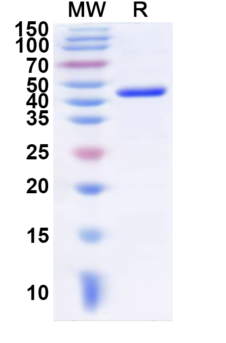SDS-PAGE for Recombinant Human NCF4 Protein, N-His