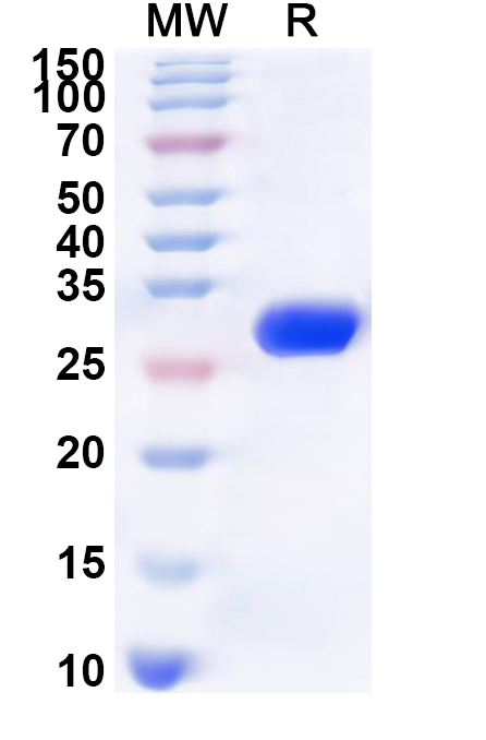 SDS-PAGE for Recombinant Human NCOA1 Protein, N-His